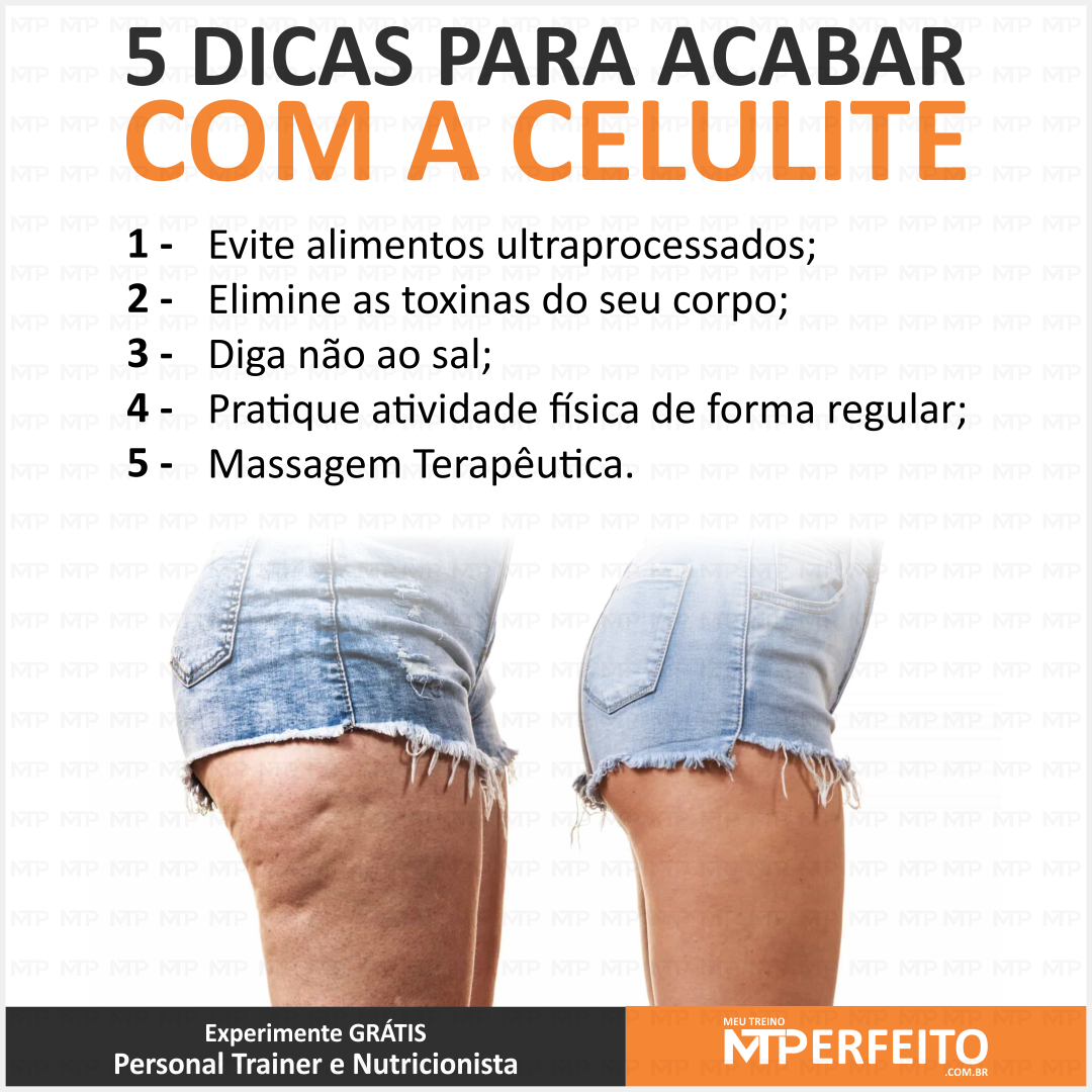 5 Dicas para Acabar com a Celulite